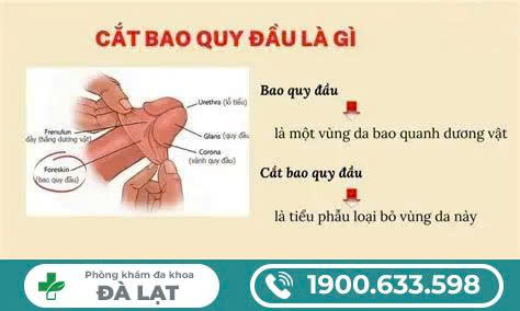 Hình ảnh minh họa